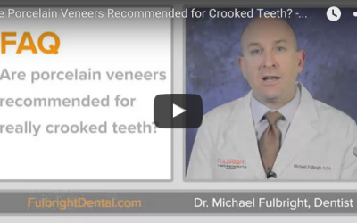 Are Porcelain Veneers Recommended for Crooked Teeth?