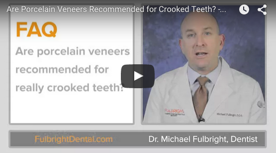 Are Porcelain Veneers Recommended for Crooked Teeth?