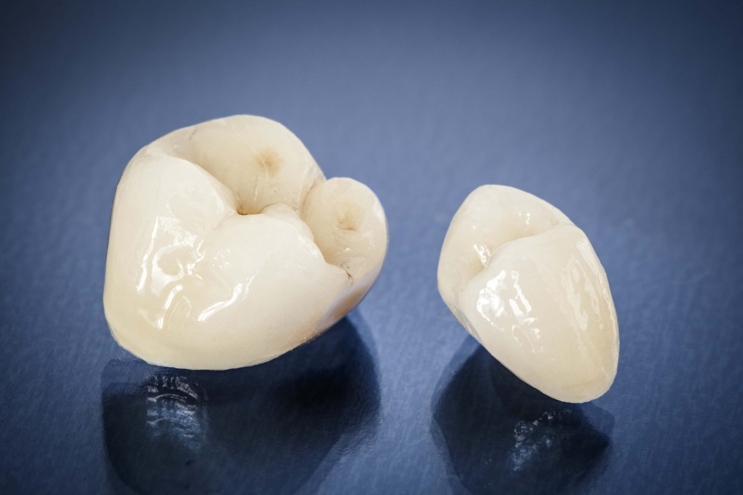 CEREC Same-Day Crowns, made in one visit and avoid the messy putty and pain and worry of temporary crowns