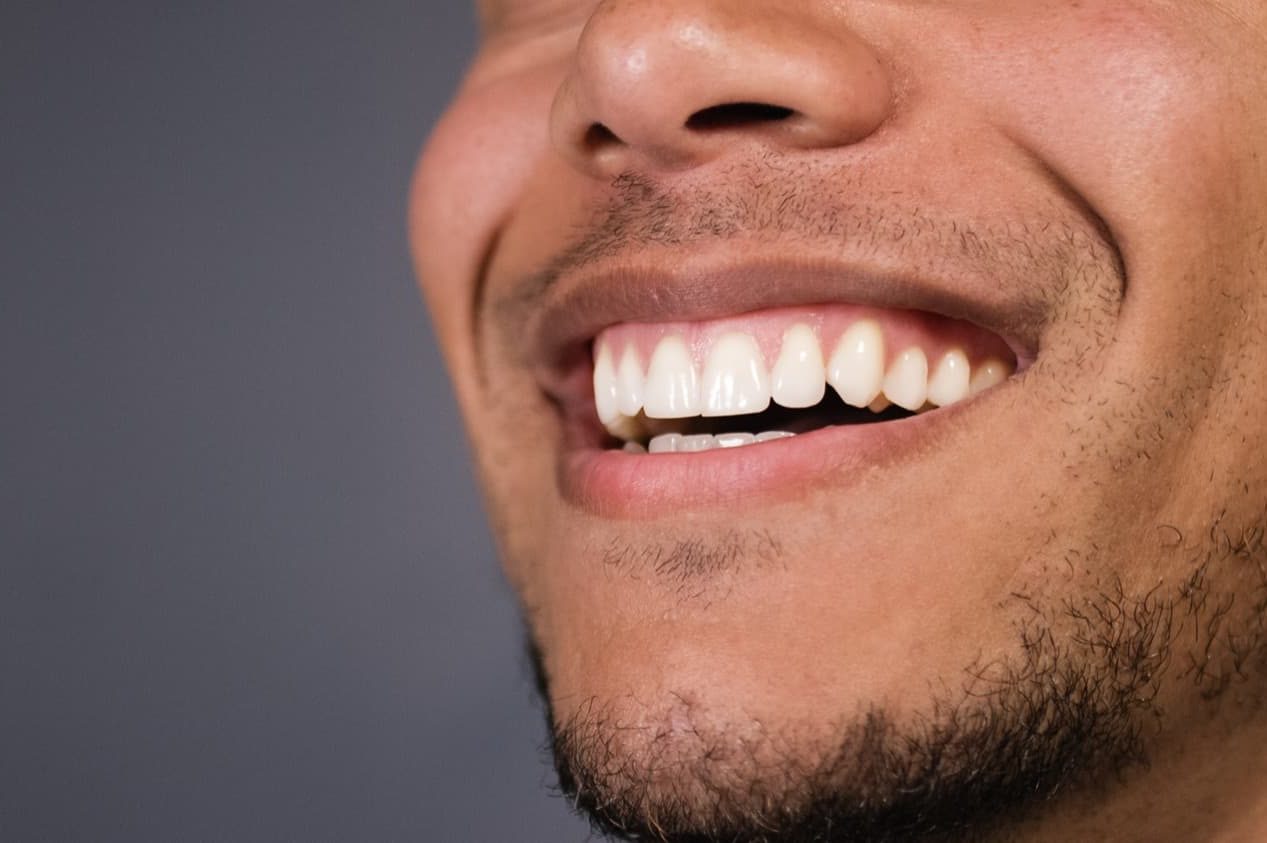 man with beautiful, straight white teeth smiling