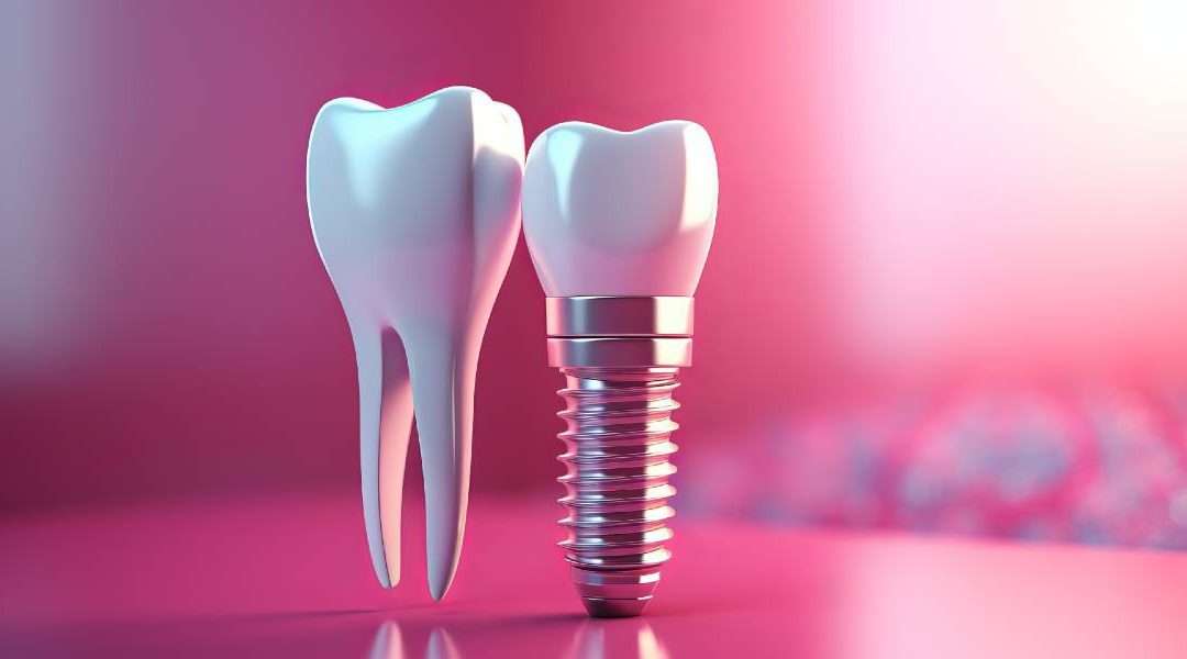 Explaining Dental Implant Supported Dentures